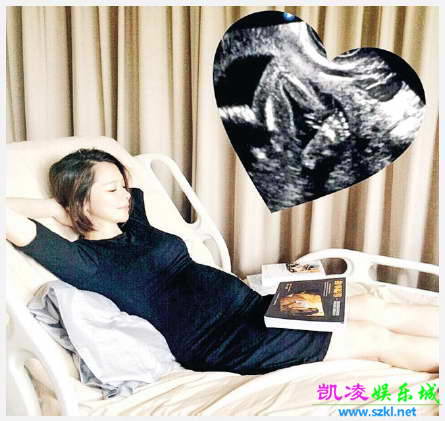 徐若瑄晒超声波照片 公布胎儿性别为男孩