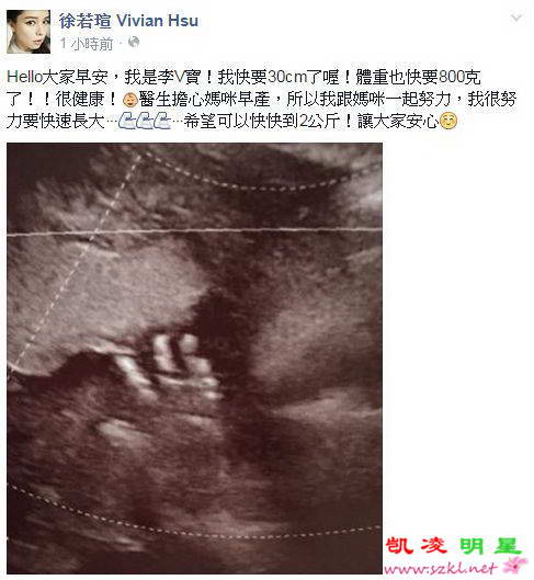 徐若瑄怀孕25周晒宝宝超声波照 网友祝福