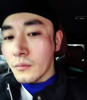 李东学因踢球受伤